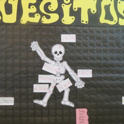 Huesitos